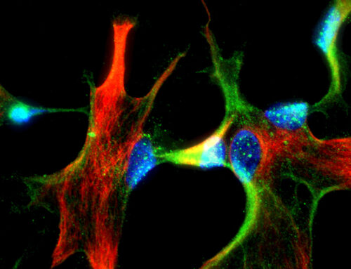 Alzheimer y la energía del cerebro